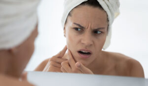 Ljetni problemi s kožom i rješenja!